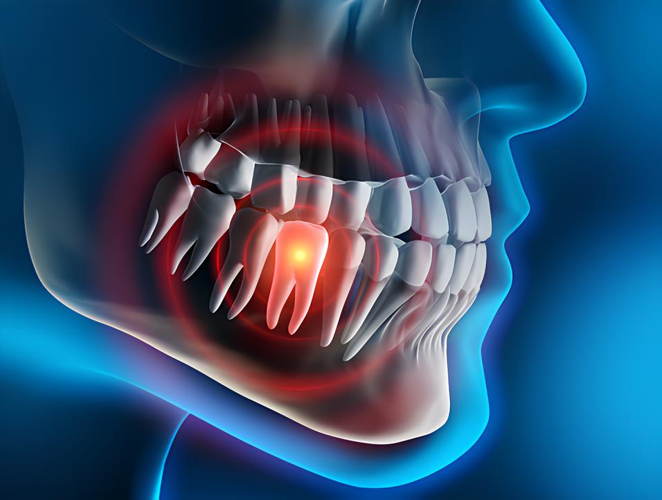 Teeth image - Emergency dentist Bath